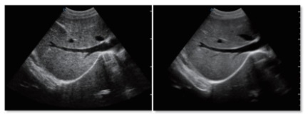 Advanced Imaging Technologies