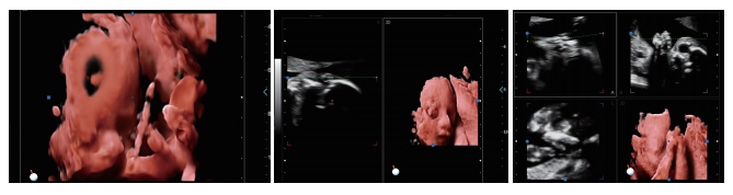 Advanced Imaging Technologies