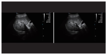 Advanced Imaging Technologies