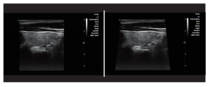 Advanced Imaging Technologies